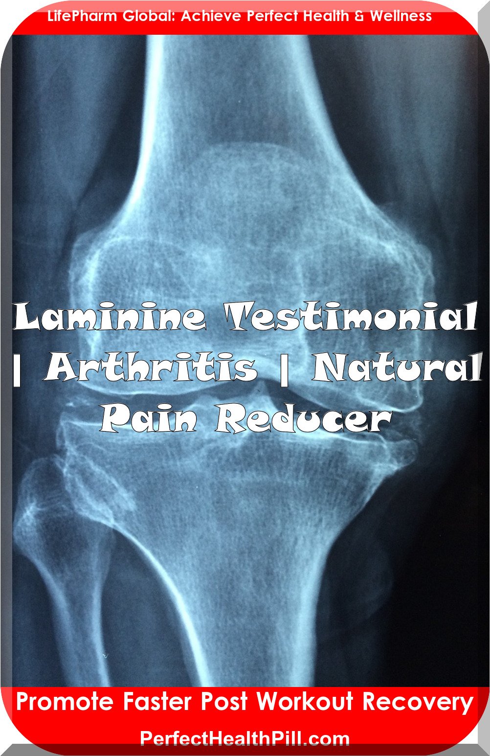 Laminine Testimonial | Ruth H. | Natural Pain Reducer